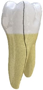 Split tooth diagram